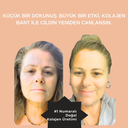 KIRIŞIKLIK GİDERİCİ KOLAJEN BANT