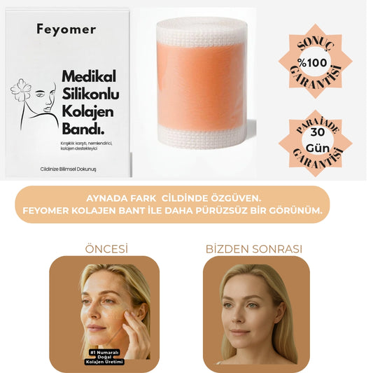 KIRIŞIKLIK GİDERİCİ KOLAJEN BANT