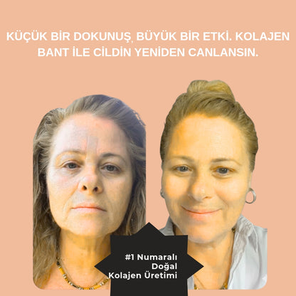 KIRIŞIKLIK GİDERİCİ KOLAJEN BANT